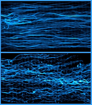 Top: Microtubules in a resting heart muscle cell. Bottom: Microtubules contracted in a beating heart muscle cell. (Image: Lab of Ben Prosser, Ph.D., Perelman School of Medicine, University of Pennsylvania)